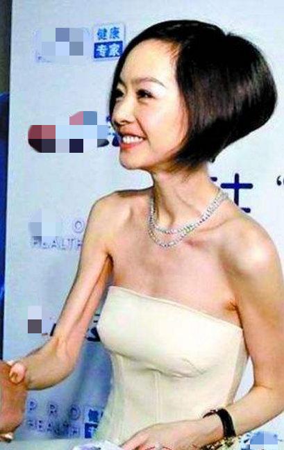 不良人蛊王变成了瘦骷髅?(骨瘦如柴详情剧情介绍)