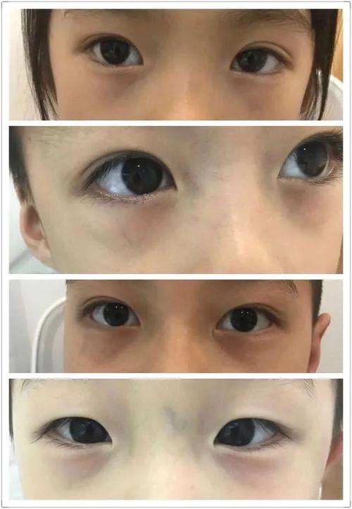10岁小孩脸色发黑是什么原因？（小孩好黑剧情介绍）